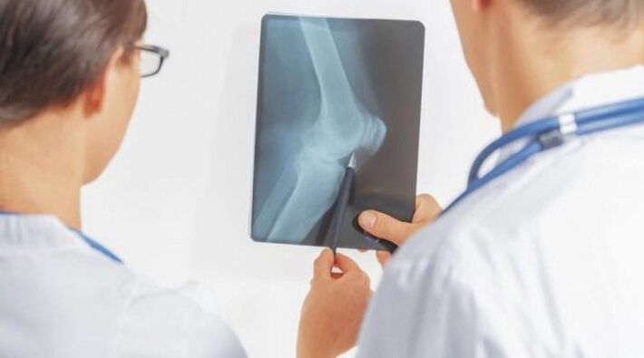 After the necessary diagnosis of osteoarthritis of the knee joint, doctors prescribe complex treatment. 