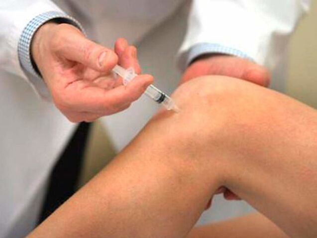 Intra-articular injection is one of the most progressive forms of treatment for osteoarthritis of the knee joint. 