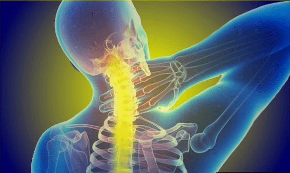 The cervical department hurts