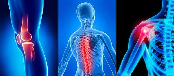 Joint pain in osteoarthritis