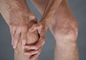 How does osteoarthritis of the knee joint manifest