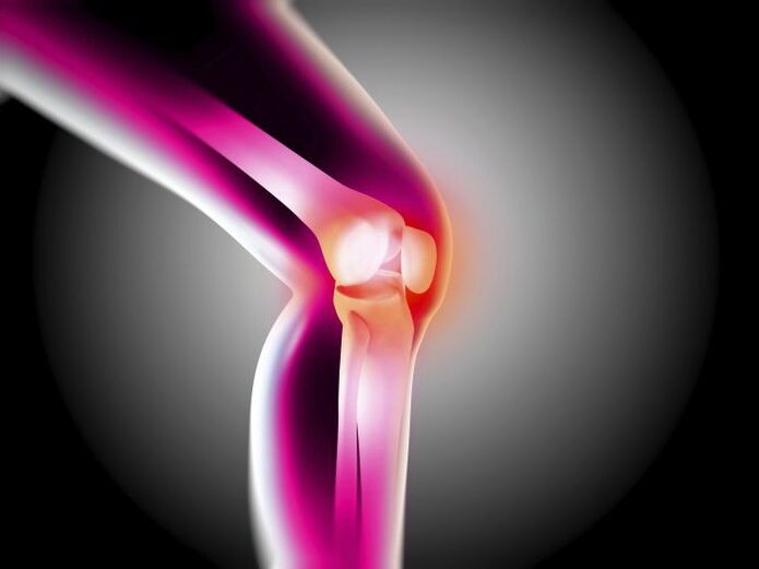 Osteoarthritis